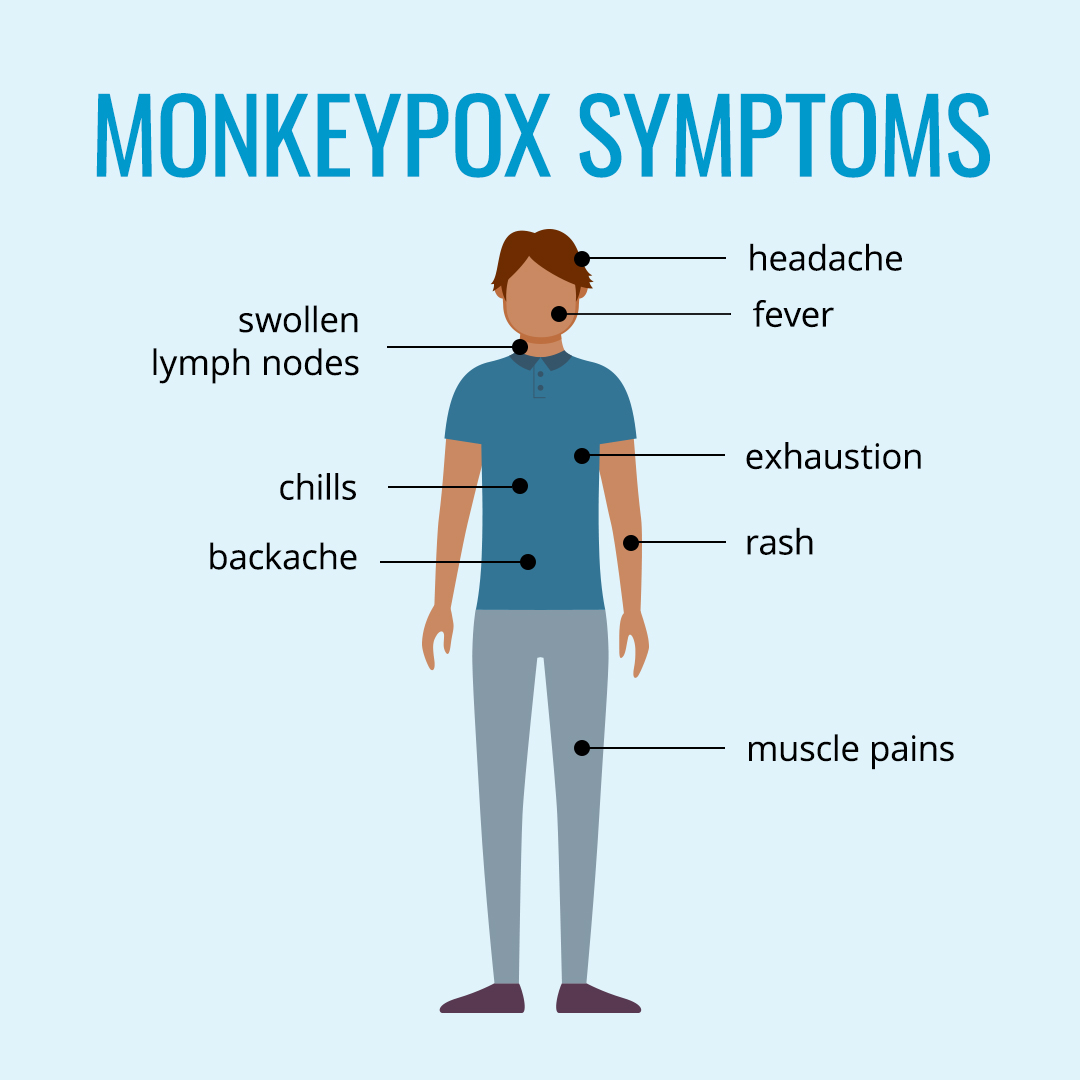 infograph of monkeypox symptoms